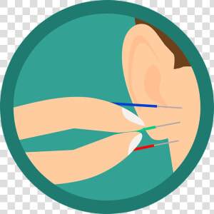 Acupuncture  Ear  Needles  Needle  Treatment   Listen To Advice Clipart  HD Png Download