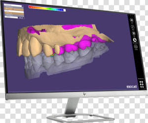 Led backlit Lcd Display  HD Png Download