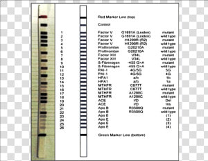 Cvd Strip Assay Viennalab  HD Png Download