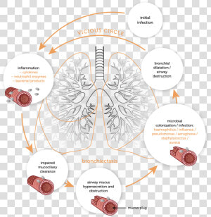 Physiology   Vicious Cycle   Vicious Cycle Of Bronchiectasis  HD Png Download