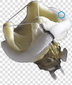 Epic Bioprosthesis Mitral Implantation  HD Png Download