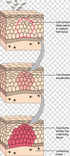 418 Development Of Cancer   Tissue And A Cell Diagram  HD Png Download