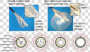 Bullfrog Microinfusion Device  HD Png Download