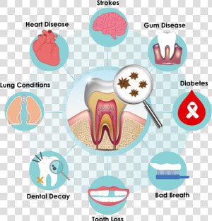 Improve Your Today With Lab A Recent   Dental Disease Clip Art  HD Png Download