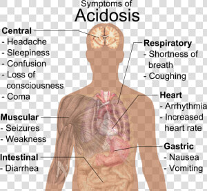 Symptoms Of Acidosis  HD Png Download