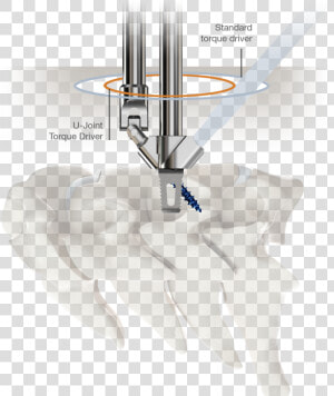 U joint Torque Driver   Stand Alone Cervical Driver  HD Png Download