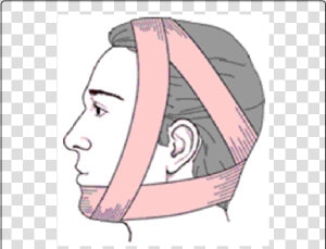 Tmj Dislocation Bandage  HD Png Download