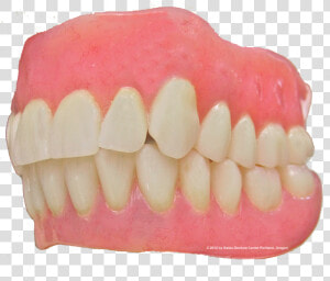 Custom Made Denture   Tongue  HD Png Download