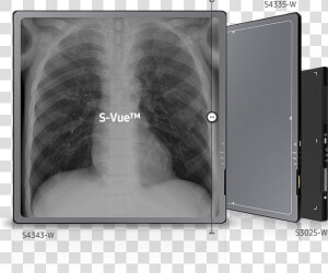 Xray Png  Transparent Png