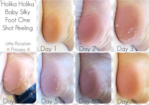 My Feet Did Peel Lightly For A Couple Of Days After   Skin Republic Foot Peel Review  HD Png Download