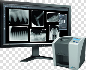 Im3 Cr7 Vet Dental Xray System   Cr7 Im3  HD Png Download