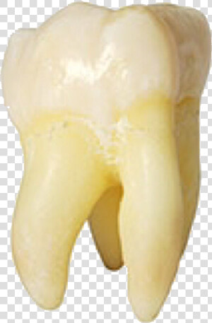  tooth  teeth  molar  rootcanal  freetoedit   Beige Tooth Png  Transparent Png