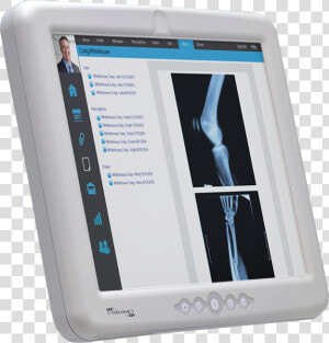 Cybermed M17s Medical Device Computer   Tablet Computer  HD Png Download