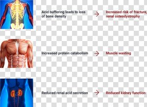 Image Depicting Serious Consequences Of Chronic Metabolic   Art  HD Png Download