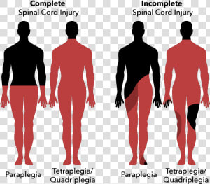 Types Of Spinal Cord Injury  HD Png Download