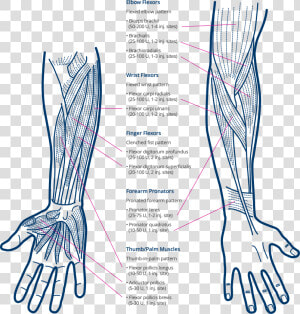 Xeomin Treatment Response   Drawing  HD Png Download