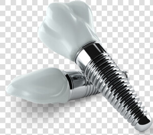 Dental Implants   Dental Implants Png  Transparent Png