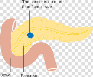 Pancreas Svg  HD Png Download