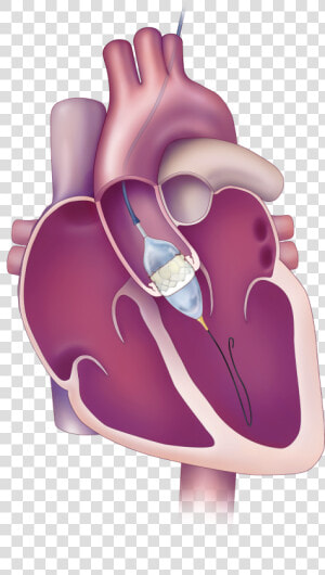 Aortic Valve  HD Png Download