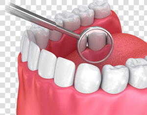 Illustration Of Dental Mirror And Teeth   Steel  HD Png Download