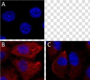 W16155a A647 Cytokeratin 7 Icc   Circle  HD Png Download