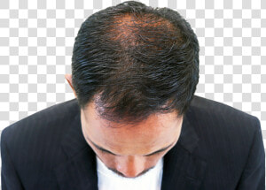 Hair Growth Dr Batra Review  HD Png Download