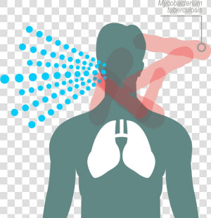 Pulmones Con Tuberculosis Png  Transparent Png