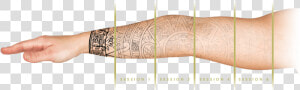 Tri Beam Tattoo Removal Results  HD Png Download