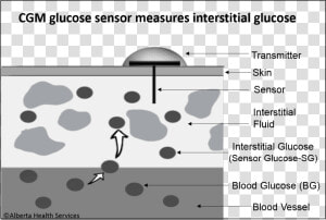 Interstitial Glucose Cgm 4ahs   Continuous Glucose Monitoring Works  HD Png Download