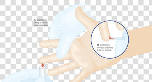 Collecting A Finger Capillary Blood Sample Via Blood   Blood Collection Procedures Adult Hand  HD Png Download