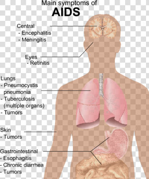 Symptoms Of Aids   Aids Symptoms Png  Transparent Png