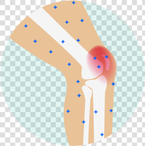 Pain Clipart Stiffness   Knee Pain Cartoon Png  Transparent Png