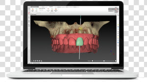 Digital Dentistry Workflow Courses   Netbook  HD Png Download