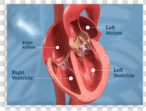 Get More Clarity About Your Dvt Treatment Options   Severe Aortic Stenosis  HD Png Download