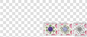 Cell  Disease  En  Nerve  Sachs   Png Download   Tay Sachs Disease  Transparent Png