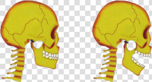 Tmj Disorders Jaw Joint Pain   Skull  HD Png Download