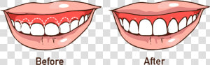 Advanced Dental Care   Straight Line Teeth  HD Png Download