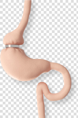 Stomach With A Lap Band   Chair  HD Png Download