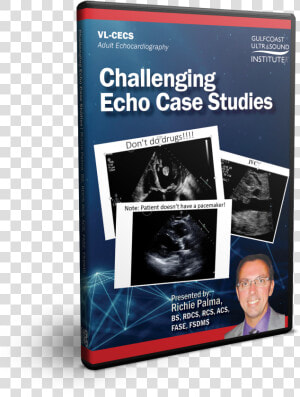 Challenging Echo Case Studies   Novel  HD Png Download