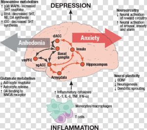 Inflammation Model Of Depression  HD Png Download