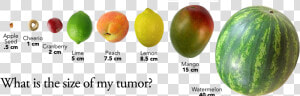 Big Is 2 Cm Tumor  HD Png Download