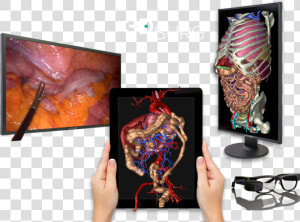 3d Technology Applied To Surgery   Graphic Design  HD Png Download