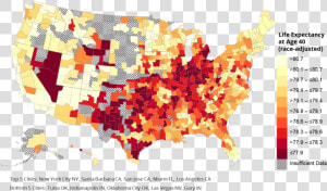 New Research Shows That Life Expectancy For Those In   America Life Expectancy  HD Png Download