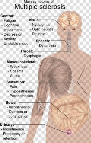 Symptoms Of Multiple Sclerosis   Esclerosis Multiple Del Sistema Nervioso  HD Png Download