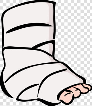 Broken Legs Png  Picture   Broken Leg Clipart Png  Transparent Png