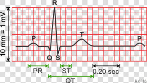 Electrocardiogram Durations And Intervals   Ecg Duration  HD Png Download