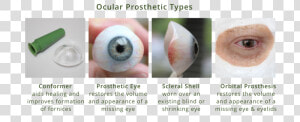 Ocular Prosthesis Types Diagram   Types Of Eye Prosthesis  HD Png Download