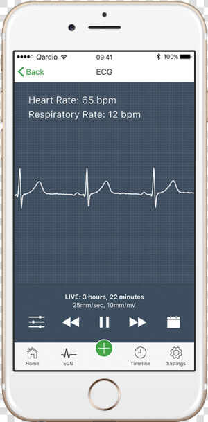 How To Read An Electrocardiogram   Atrial Fibrillation Holter Monitor  HD Png Download