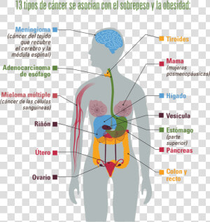 13 Tipos De Cáncer Se Asocian Con El Sobrepeso Y La   Diversos Tumores Y Cánceres Del Sistema Circulatorio  HD Png Download