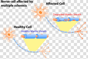 Multiple Sclerosis Nerve Cells  HD Png Download